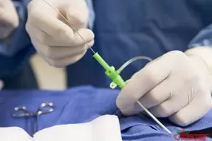 Хирургия одного дня в медицинском центре «Авиценна Медикал»