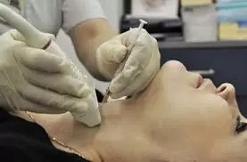 punktsiya-shhitovidnoj-zhelezy